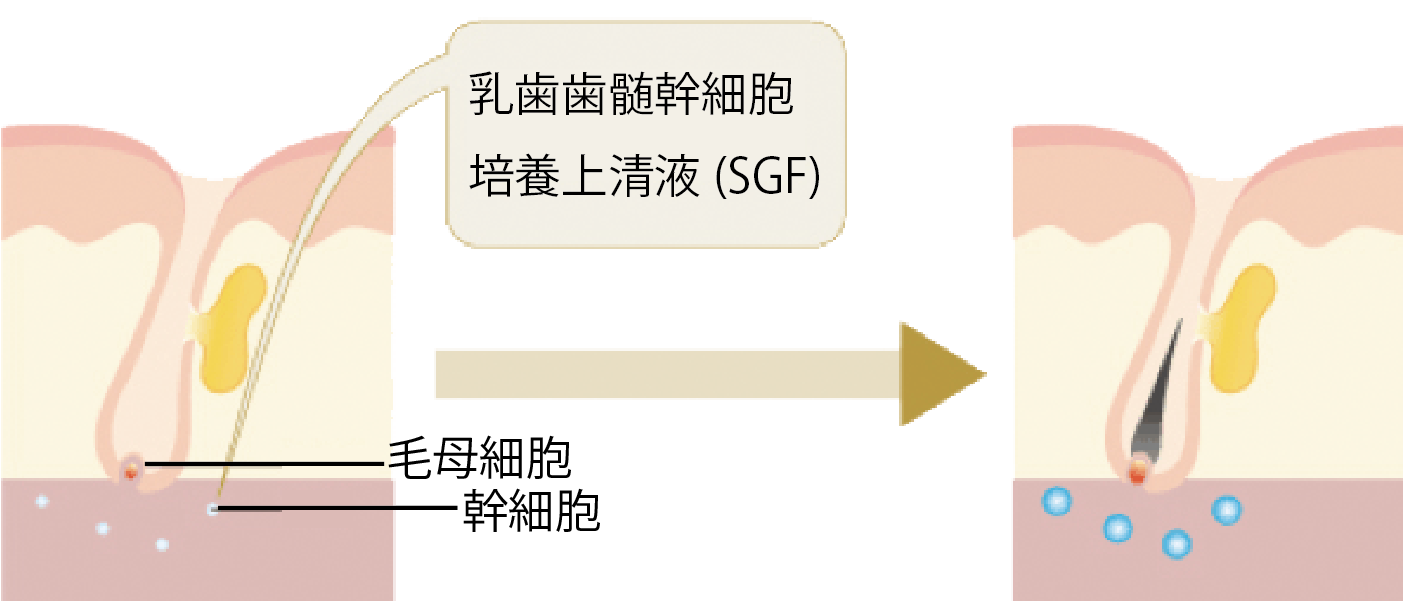 AGA治療・薄毛予防